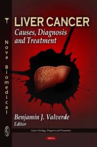 cover of the book Liver Cancer: Causes, Diagnosis and Treatment : Causes, Diagnosis and Treatment