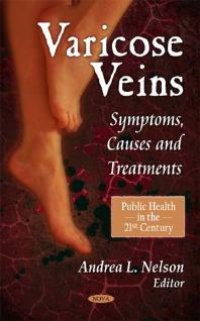 cover of the book Varicose Veins: Symptoms, Causes and Treatments : Symptoms, Causes and Treatments