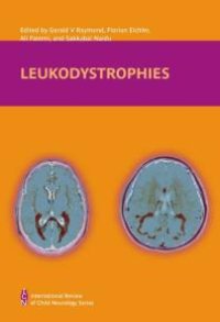 cover of the book Leukodystrophies