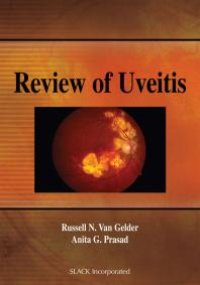 cover of the book Review of Uveitis