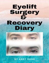 cover of the book Eyelift Surgery and Recovery Diary: Ptosis, eyelifts, punctal plugs, and dry eyes