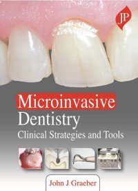 cover of the book Microinvasive Dentistry: Clinical Strategies and Tools