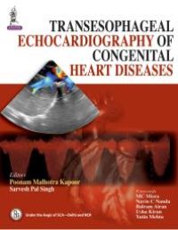 cover of the book Transesophageal Echocardiography of Congenital Heart Diseases