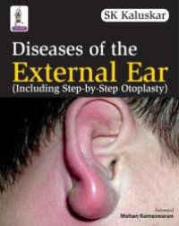 cover of the book Diseases of the External Ear (Including Step-By-Step Otoplasty)