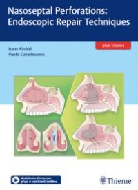 cover of the book Nasoseptal Perforations: Endoscopic Repair Techniques