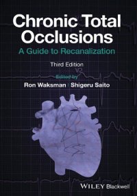 cover of the book Chronic Total Occlusions: A Guide to Recanalization [Team-IRA]