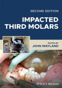 cover of the book Impacted Third Molars [Team-IRA]