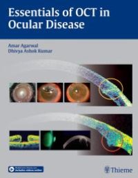 cover of the book Essentials of OCT in Ocular Disease