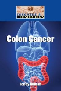 cover of the book Colon Cancer