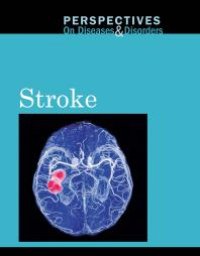 cover of the book Stroke