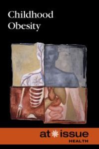 cover of the book Childhood Obesity