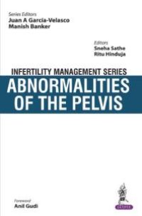 cover of the book Infertility Management Series: Abnormalities of the Pelvis