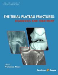 cover of the book The Tibial Plateau Fractures: Diagnosis and Treatment