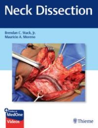 cover of the book Neck Dissection