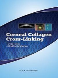 cover of the book Corneal Collagen Cross Linking