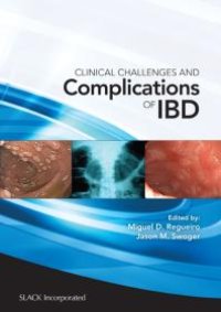 cover of the book Clinical Challenges and Complications of IBD