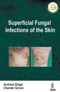 cover of the book Superficial Fungal Infections of the Skin