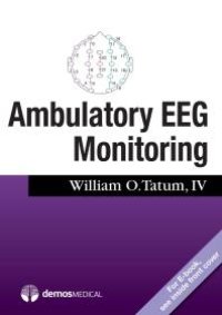 cover of the book Ambulatory EEG Monitoring