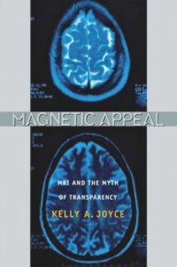 cover of the book Magnetic Appeal: MRI and the Myth of Transparency