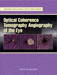 cover of the book Optical Coherence Tomography Angiography of the Eye