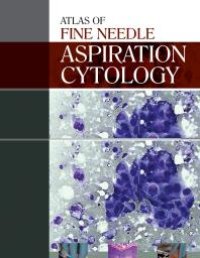 cover of the book Atlas of Fine Needle Aspiration Cytology