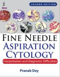 cover of the book Fine Needle Aspiration Cytology: Interpretation and Diagnostic Difficulties