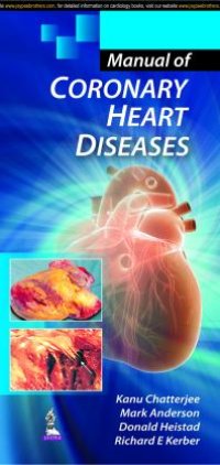 cover of the book Manual of Coronary Heart Diseases