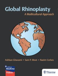 cover of the book Global Rhinoplasty: A Multicultural Approach