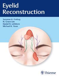 cover of the book Eyelid Reconstruction