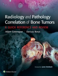 cover of the book Radiology and Pathology Correlation of Bone Tumors, None: A Quick Reference and Review