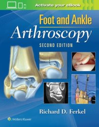 cover of the book Foot & Ankle Arthroscopy