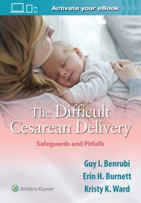 cover of the book The Difficult Cesarean Delivery: Safeguards and Pitfalls