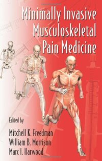 cover of the book Minimally Invasive Musculoskeletal Pain Medicine (Minimally Invasive Procedures in Orthopaedic Surgery)