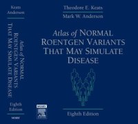 cover of the book Atlas of Normal Roentgen Variants That May Simulate Disease