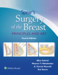 cover of the book Spear's Surgery of the Breast: Principles and Art