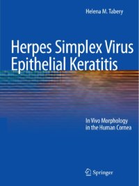 cover of the book Herpes Simplex Virus Epithelial Keratitis: In Vivo Morphology in the Human Cornea