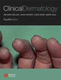 cover of the book Clinical Dermatology, 4th edition