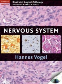 cover of the book Nervous System (Cambridge Illustrated Surgical Pathology)