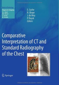 cover of the book Comparative Interpretation of CT and Standard Radiography of the Chest