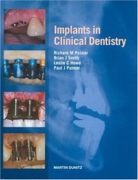 cover of the book Implants in Clinical Dentistry