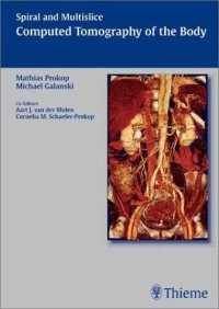 cover of the book Spiral and Multislice Computed Tomography of the Body ( THIEME )