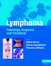 cover of the book Lymphoma: Pathology, Diagnosis and Treatment