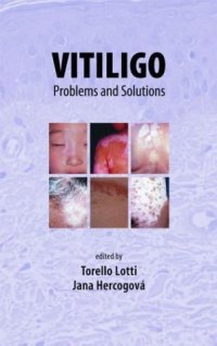 cover of the book Vitiligo: Problems and Solutions