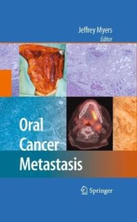 cover of the book Oral Cancer Metastasis