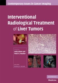 cover of the book Interventional Radiological Treatment of Liver Tumors (Contemporary Issues in Cancer Imaging)