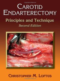 cover of the book Carotid Endarterectomy: Principles and Technique, Second Edition