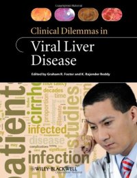 cover of the book Clinical Dilemmas in Viral Liver Disease