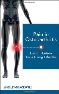 cover of the book Pain in Osteoarthritis