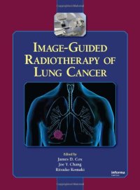 cover of the book Image-Guided Radiotherapy of Lung Cancer