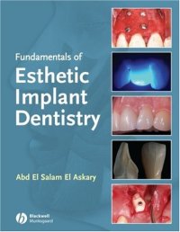 cover of the book Fundamentals of Esthetic Implant Dentistry, Second Edition